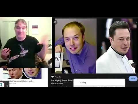 I got Asperger's like you @ElonMusk FanZone  Elon Musk, can you help me get a hair transplant, pleas